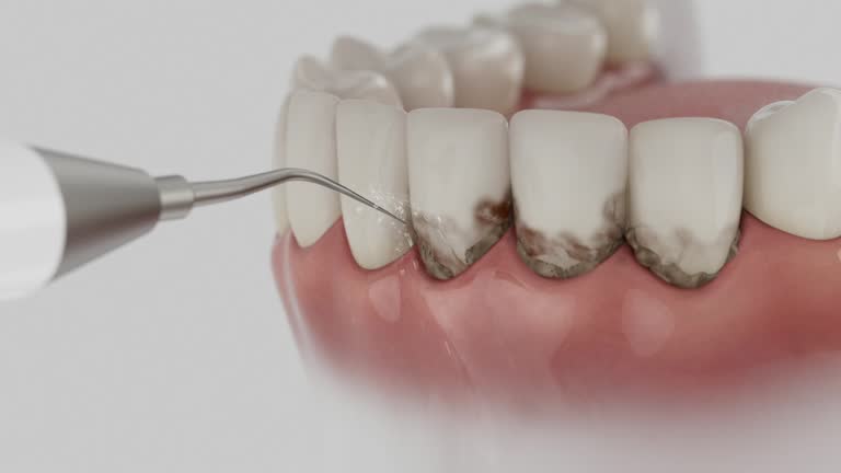 Reliable Dental contractor in Riviera Beach, FL by Smile Center Dentistry